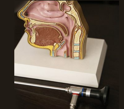 Video-Endoscopia-Nasosinusal-Diagnostica